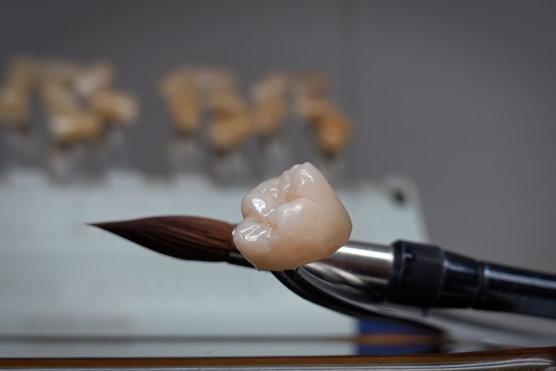 dental work